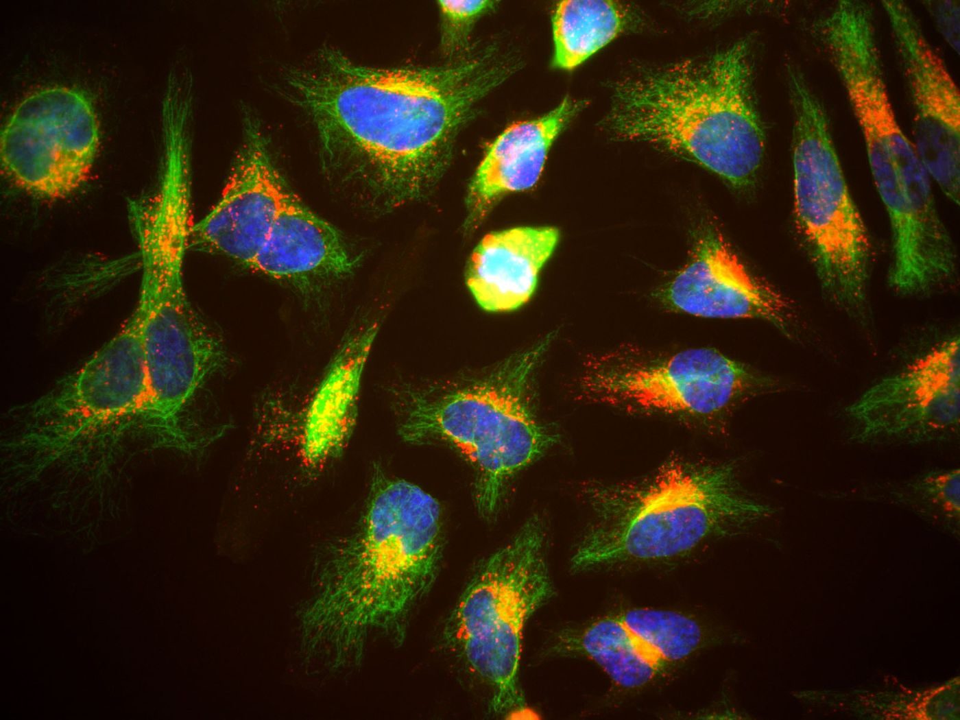 Fluorescence microscope image of human cells with lysosomes in red, a scaffold protein in green, and nuclei in blue