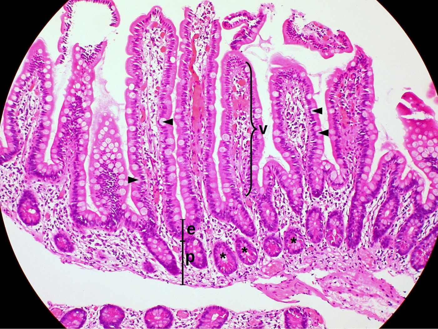 Pink and purple stained section of the small intestine showing finger-like villi