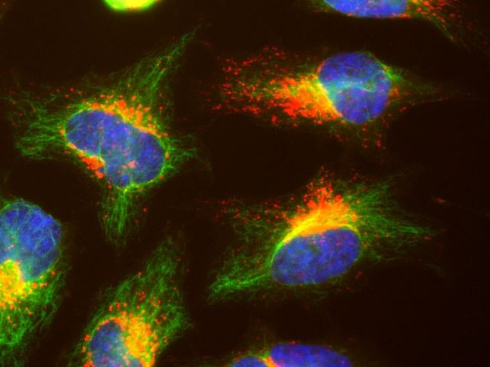 Close-up fluorescence image of human cells with many small red dots, the lysosomes, clustered around blue nuclei and green fibers