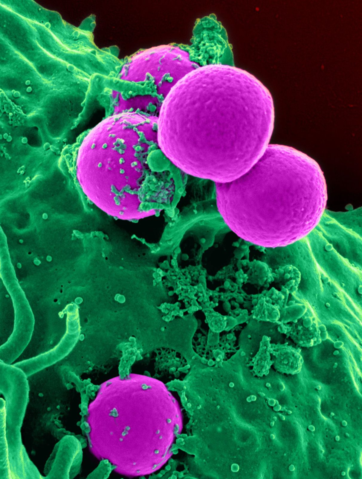 Colorized electron micrograph of a green white blood cell engulfing round purple bacteria